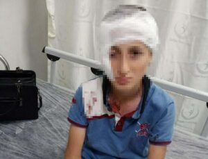 Köpek saldırısında yüzü kalıcı iz kalan çocuk için 1,2 milyon TL tazminat